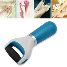 Electric Foot File Callus Remover – USB & Battery Powered