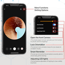 Smart Ear Cleaner Kit with HD Camera & WiFi – 6 LED Endoscope Tool for Android/iOS + 11 Free Silicone Tips (White)